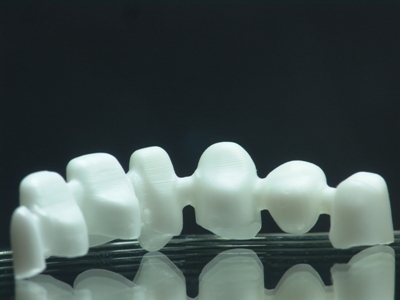 Aesthetic dental restorations